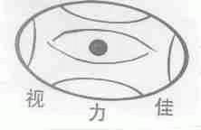 视力佳