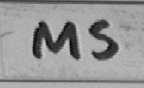MS