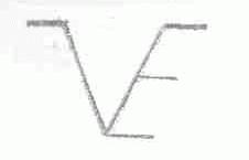 VE